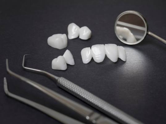 Several white dental crowns and veneers on table next to dental mirrors