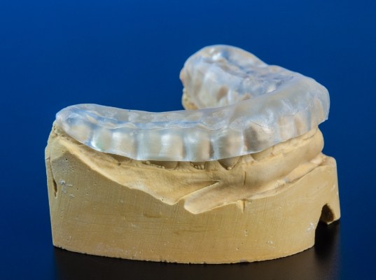 Model of the jaw with clear nightguard over the teeth