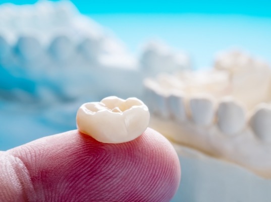 Dental crown resting on a finger