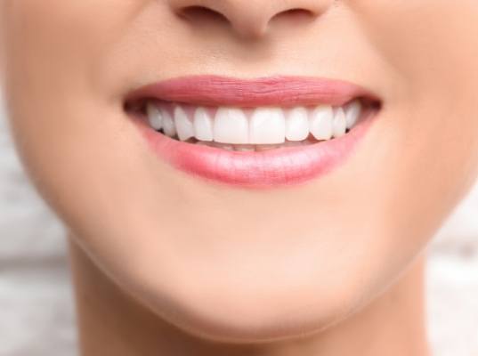Close up of person smiling with flawless teeth